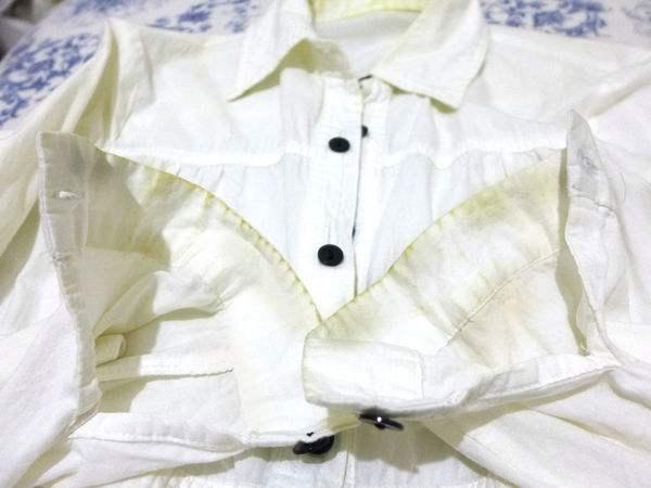 白衣服被染色發(fā)黃怎么辦？一招讓你的衣服立刻潔凈如新 必備！