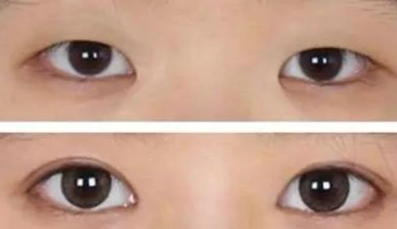 為什么內(nèi)雙最考驗(yàn)顏值，內(nèi)雙眼皮的女生顏值高嗎